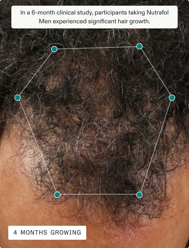 Nutrafol Men - Hair Growth Supplement