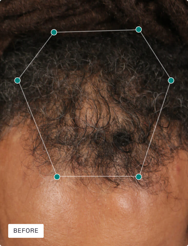 Nutrafol Men - Hair Growth Supplement
