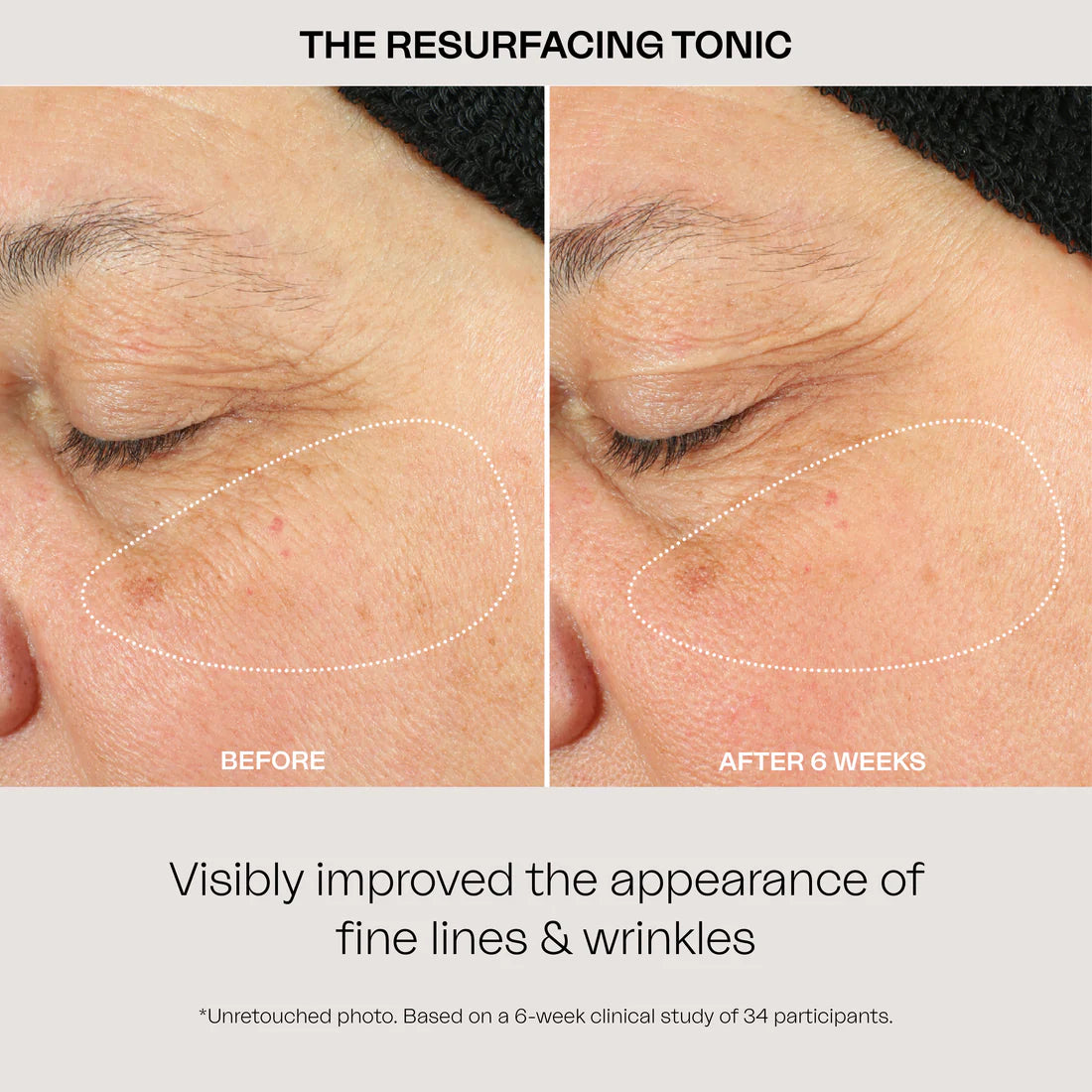 EIGHTH DAY - The Resurfacing Tonic